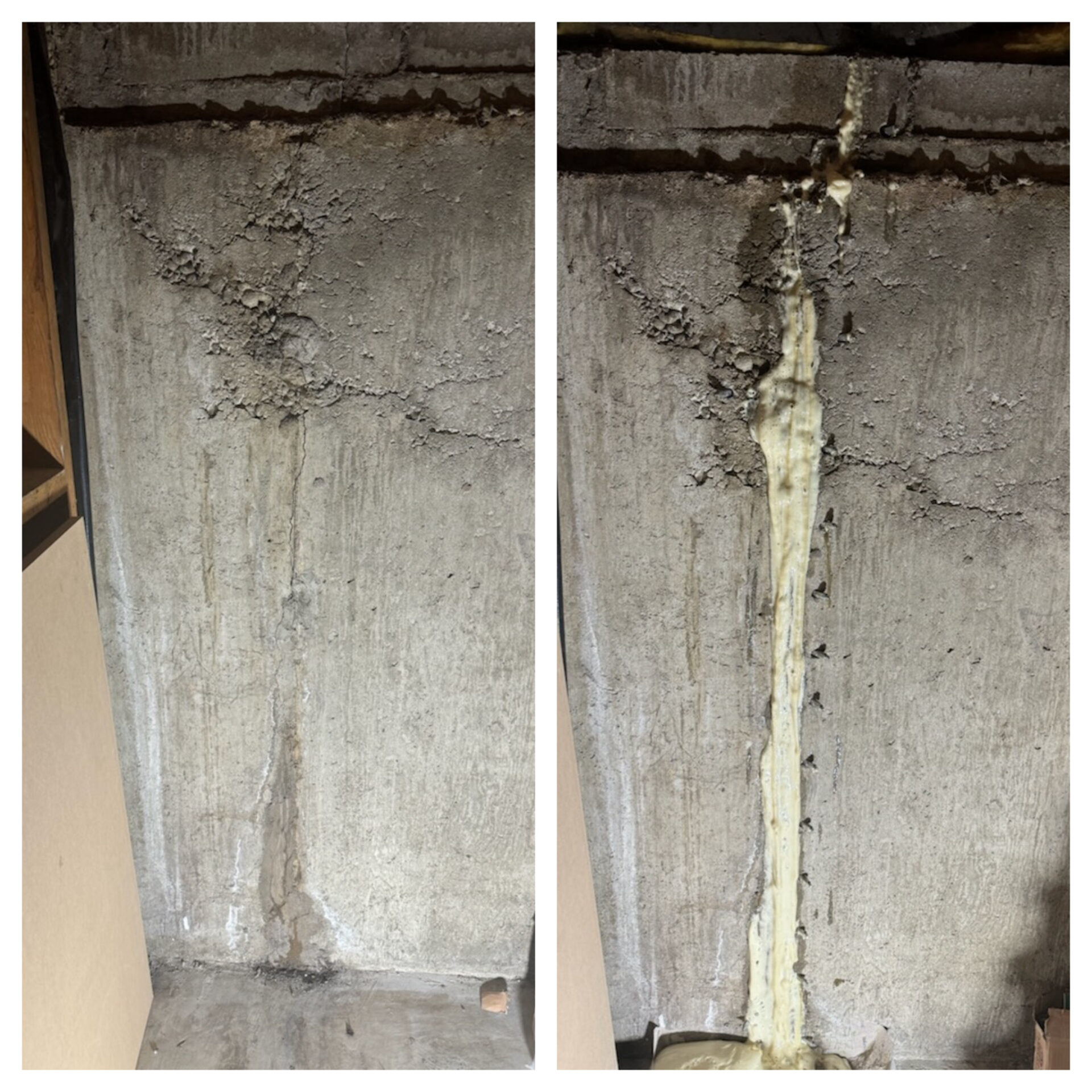 Freeze-thaw cracks in a poured-concrete cottage foundation wall sealed with polyurethane injection by Dryshield Basement Waterproofing